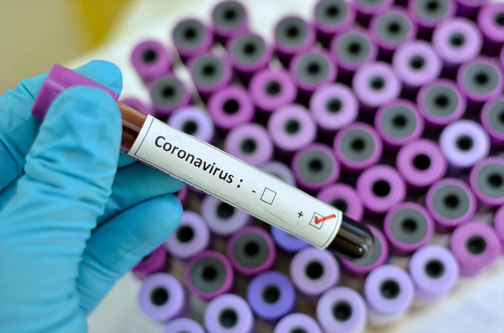 Primul caz confirmat de coronavirus în Prahova. Un tânăr de 26 de ani, întors recent acasă din Italia